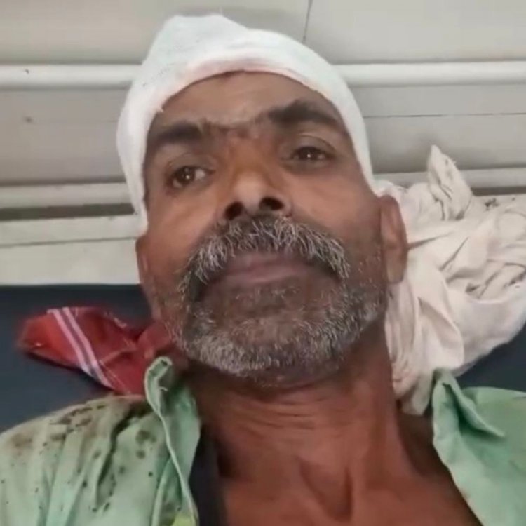 भतीजे ने चाचा पर लाठी से किया हमला:सीधी में जमीनी विवाद से नाराज था; जिला अस्पताल में भर्ती